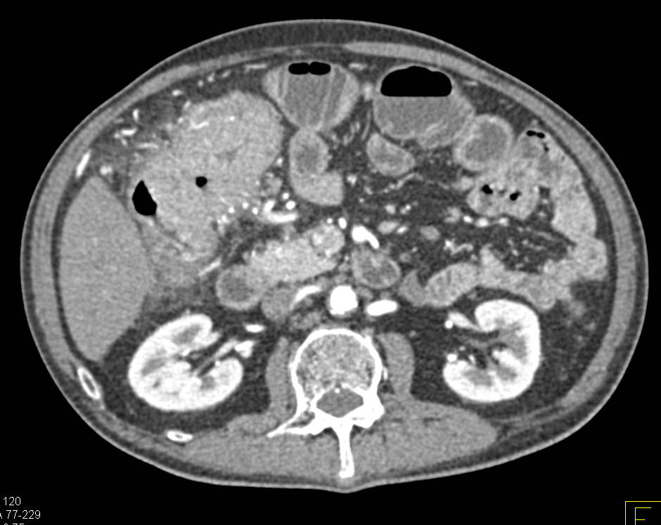CTisus Quiz