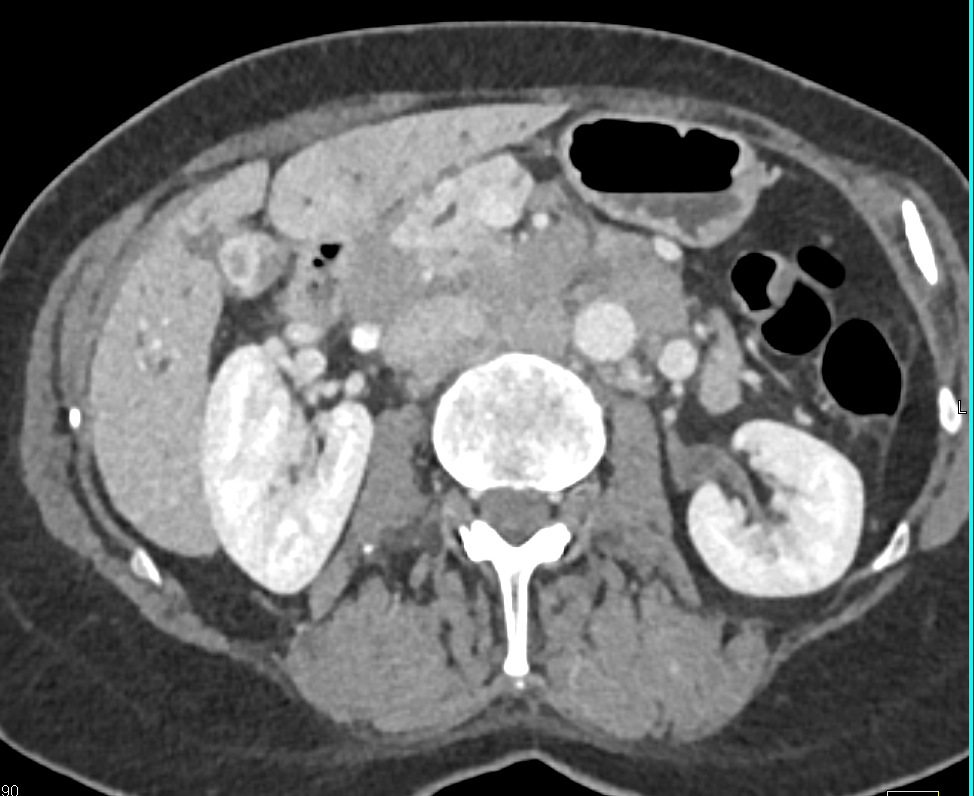 CTisus Quiz
