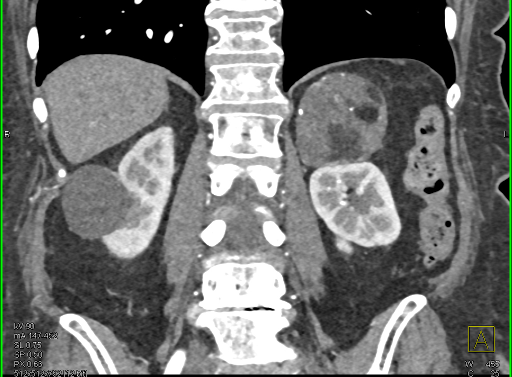 CTisus Quiz