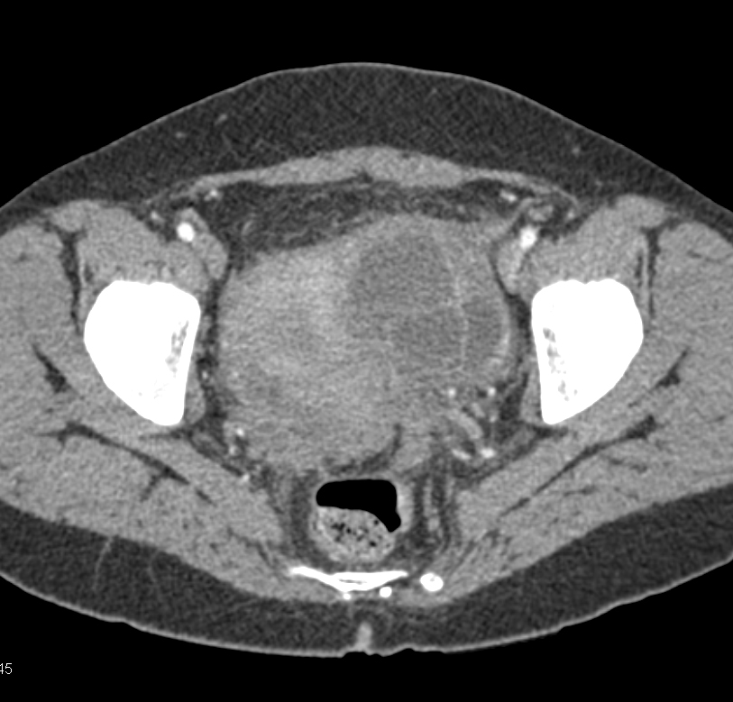 CTisus Quiz