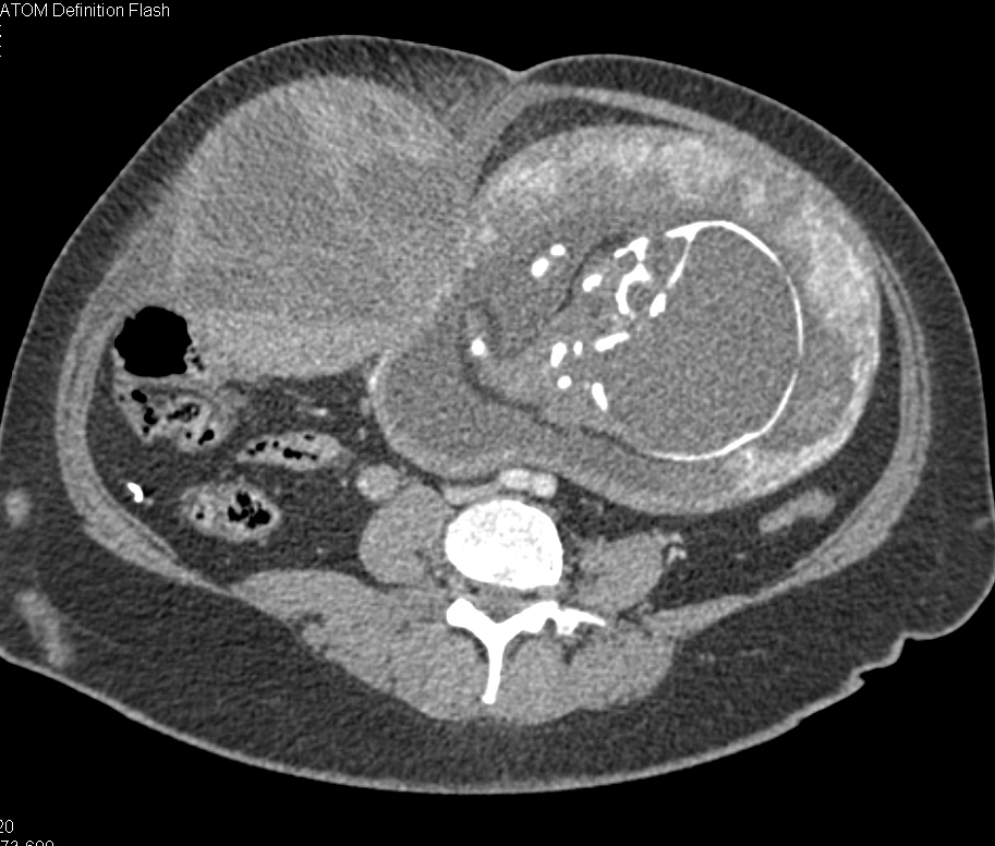 CTisus Quiz