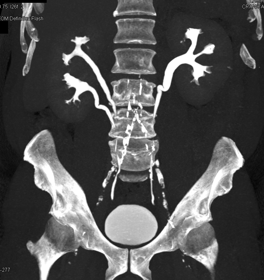 CTisus Quiz