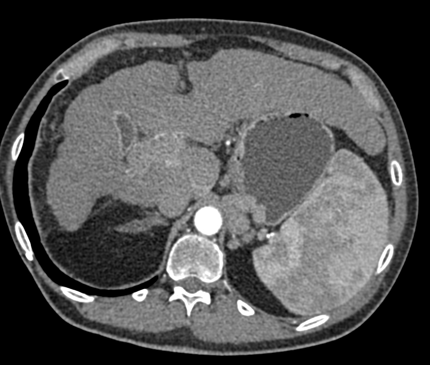 CTisus Quiz
