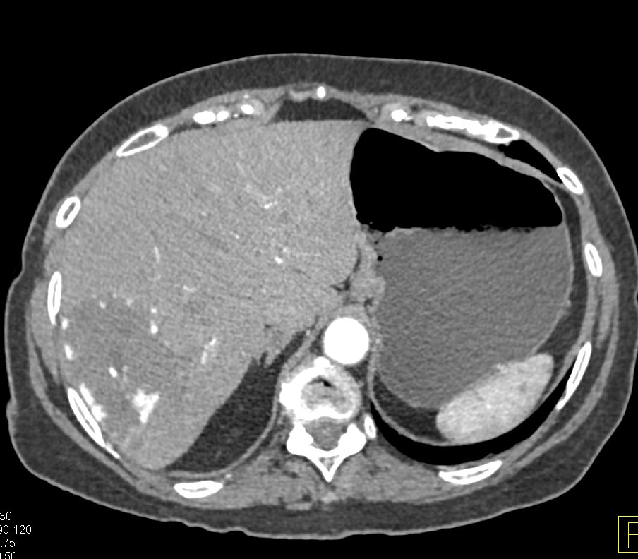 CTisus Quiz