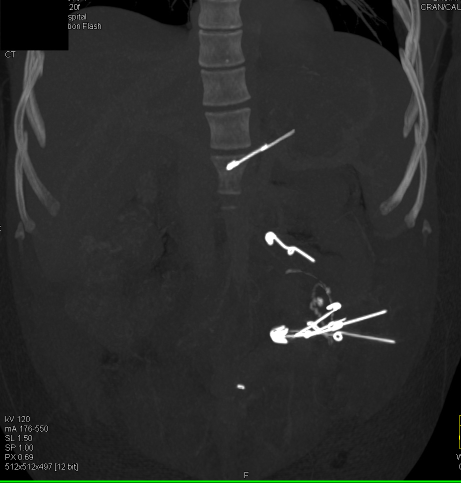CTisus Quiz