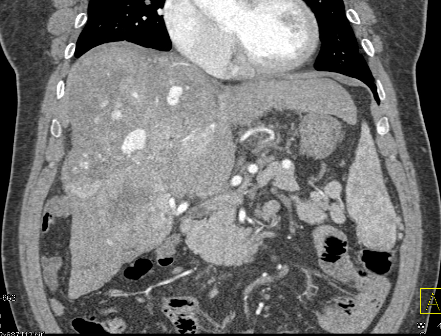 CTisus Quiz