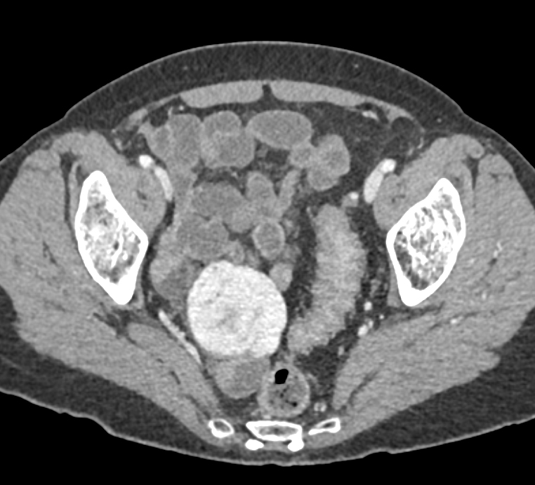 CTisus Quiz