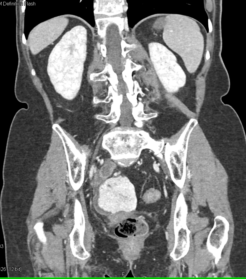 CTisus Quiz