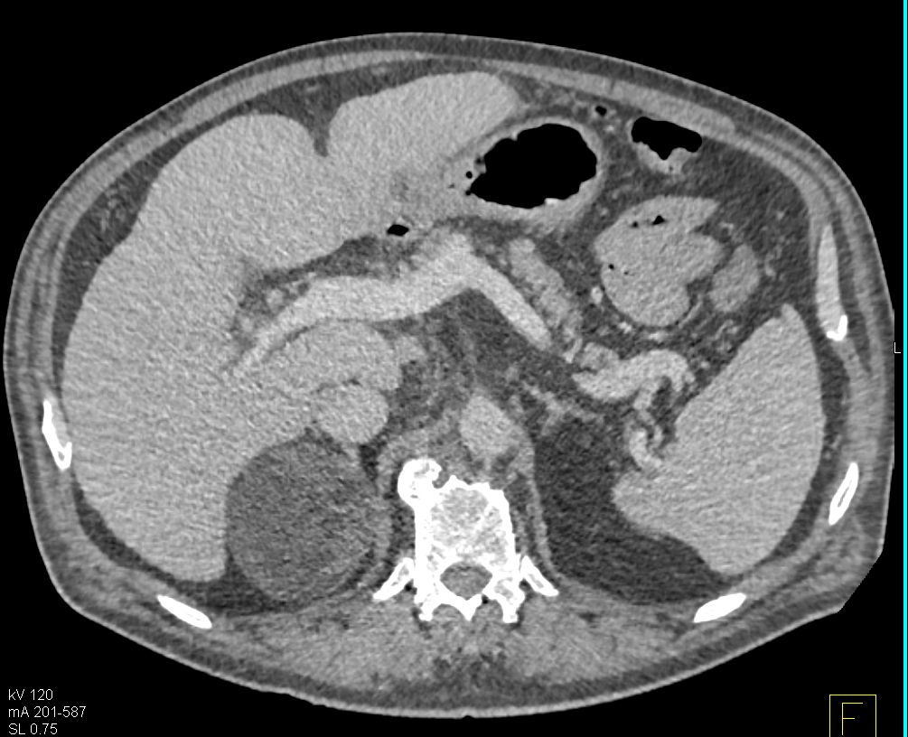 CTisus Quiz