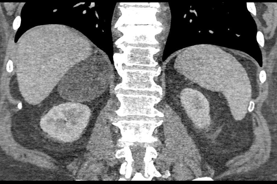 CTisus Quiz