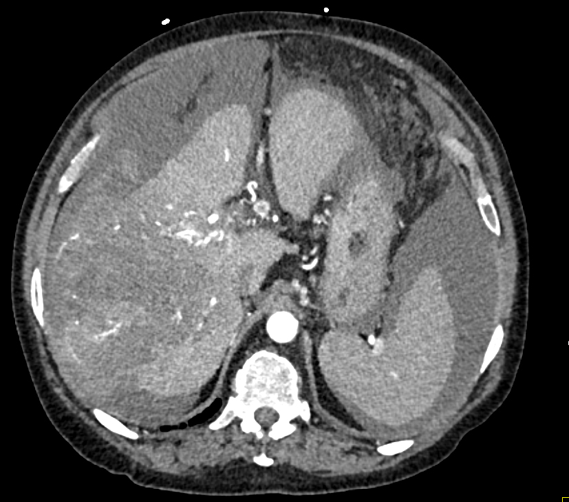CTisus Quiz