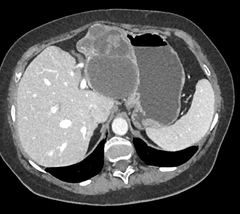 CTisus Quiz