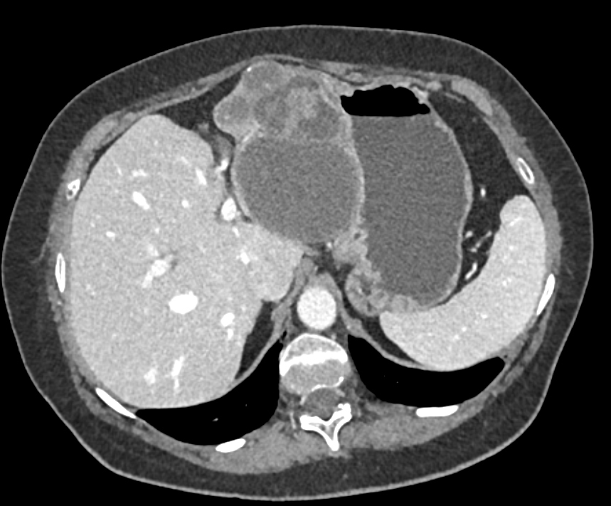 CTisus Quiz