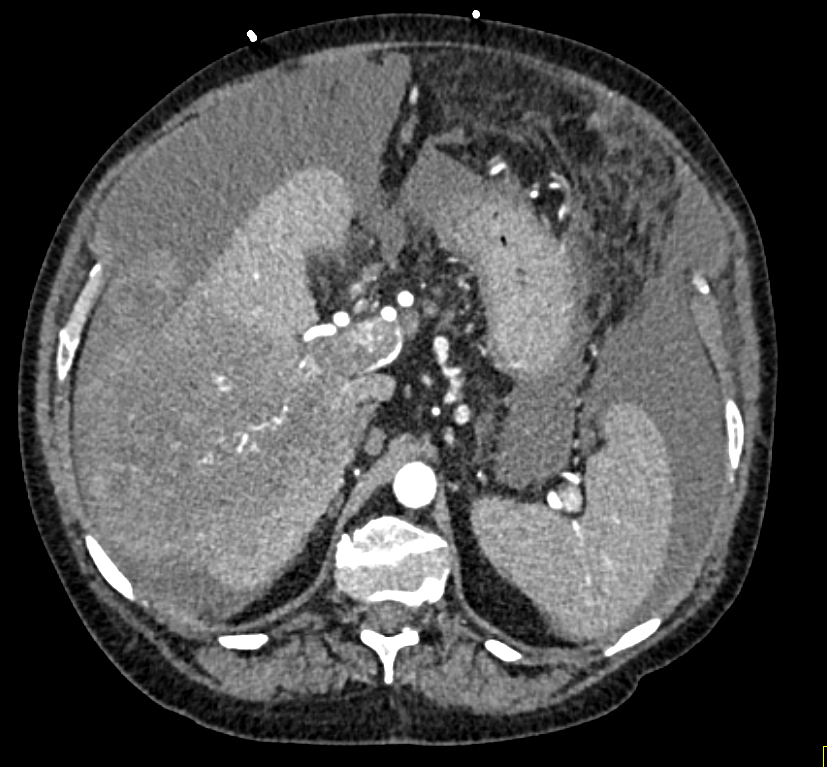 CTisus Quiz