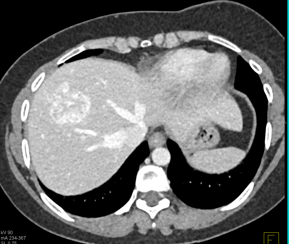 CTisus Quiz