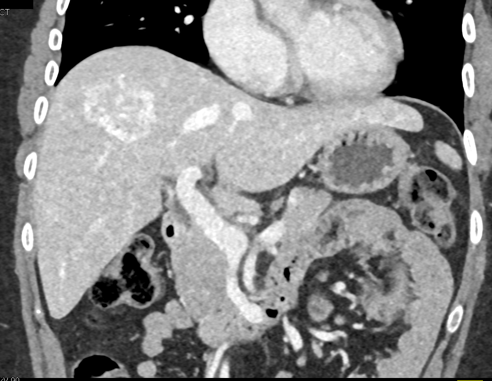 CTisus Quiz
