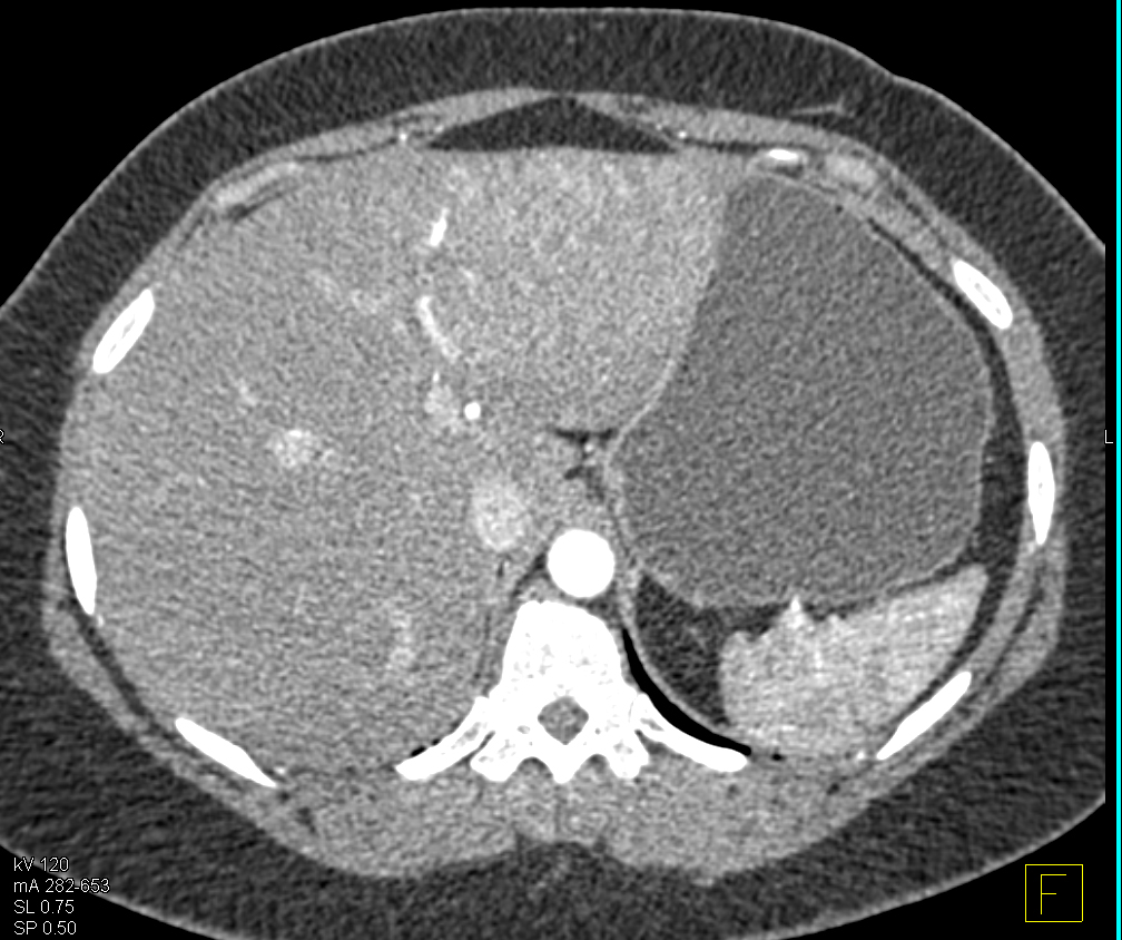 CTisus Quiz
