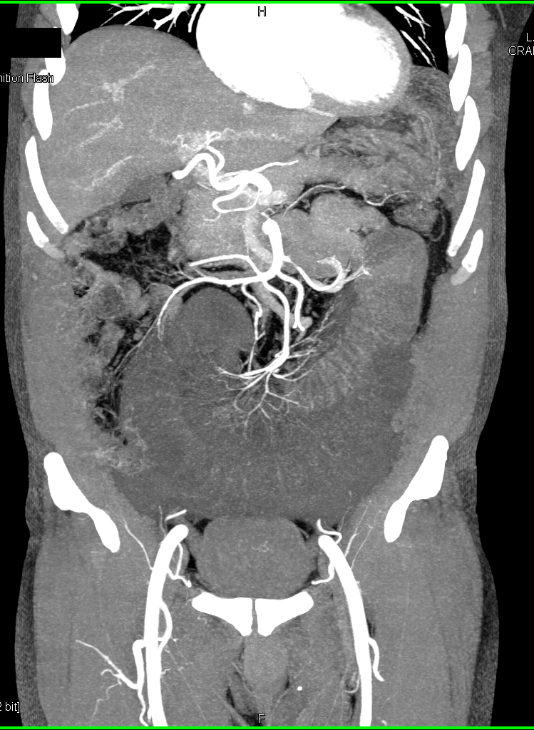 CTisus Quiz