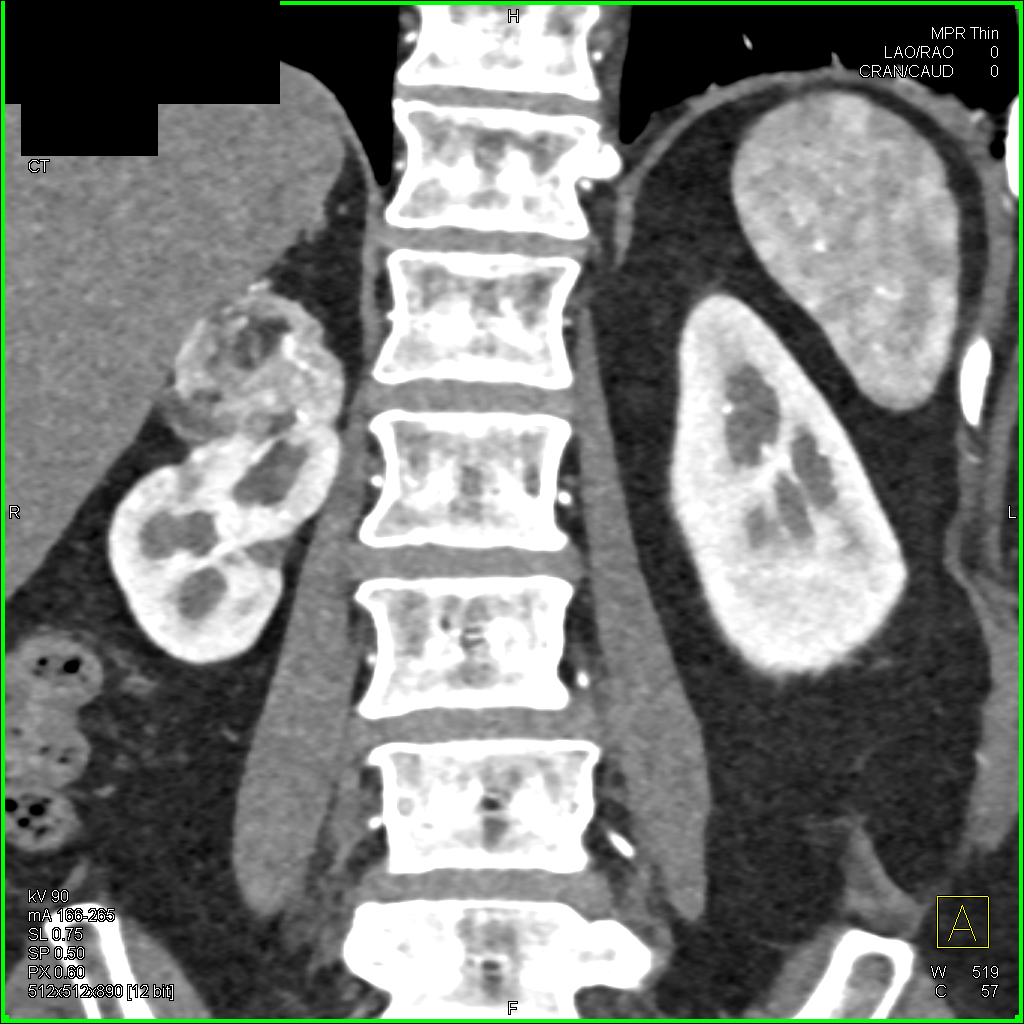 CTisus Quiz
