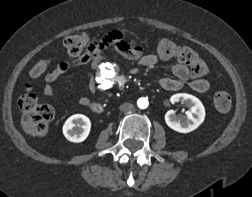 CTisus Quiz