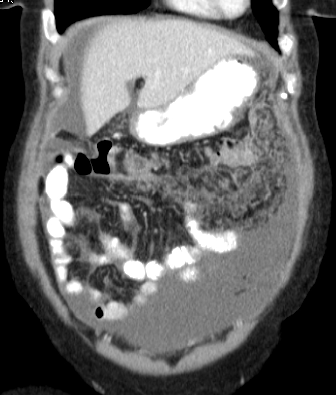 CTisus Quiz