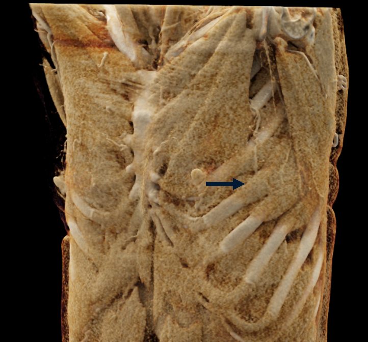 CTisus Quiz