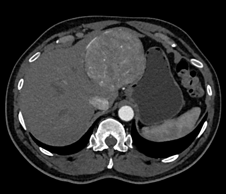 CTisus Quiz