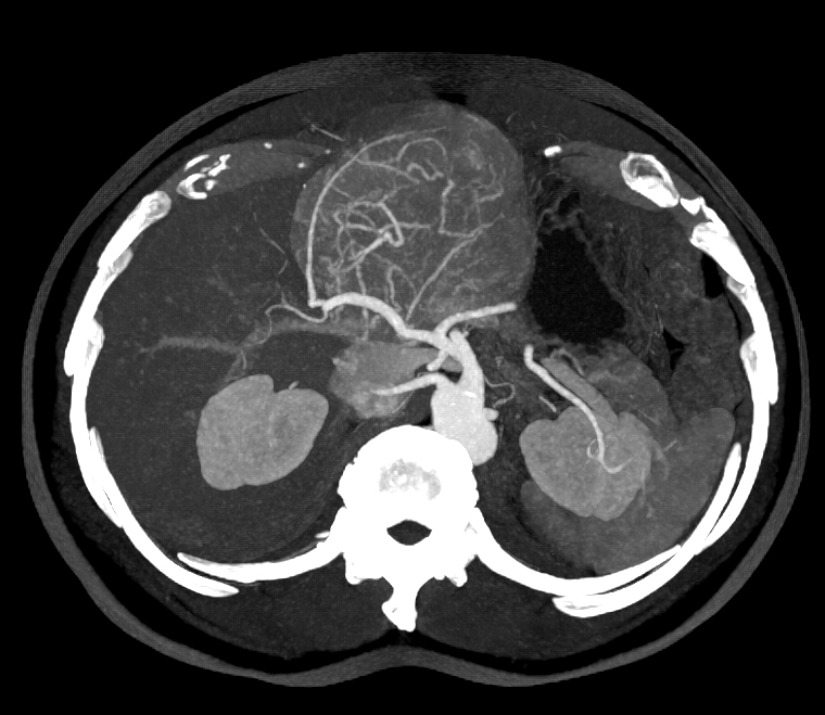 CTisus Quiz