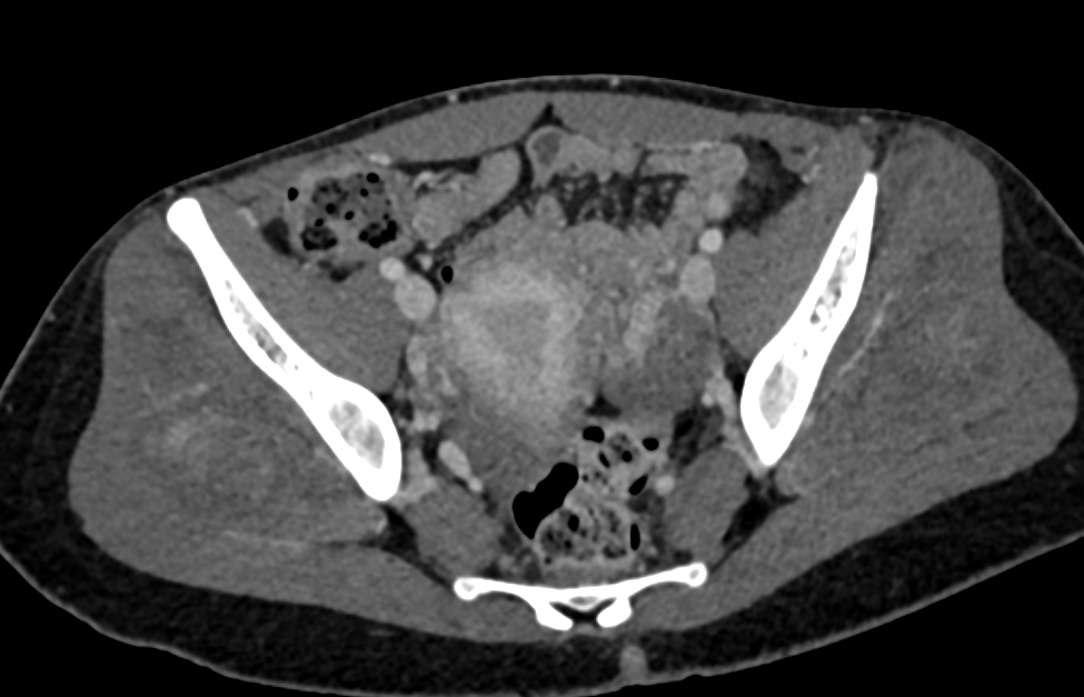 CTisus Quiz