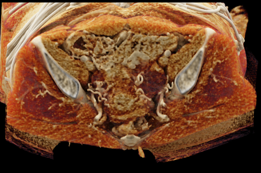 CTisus Quiz