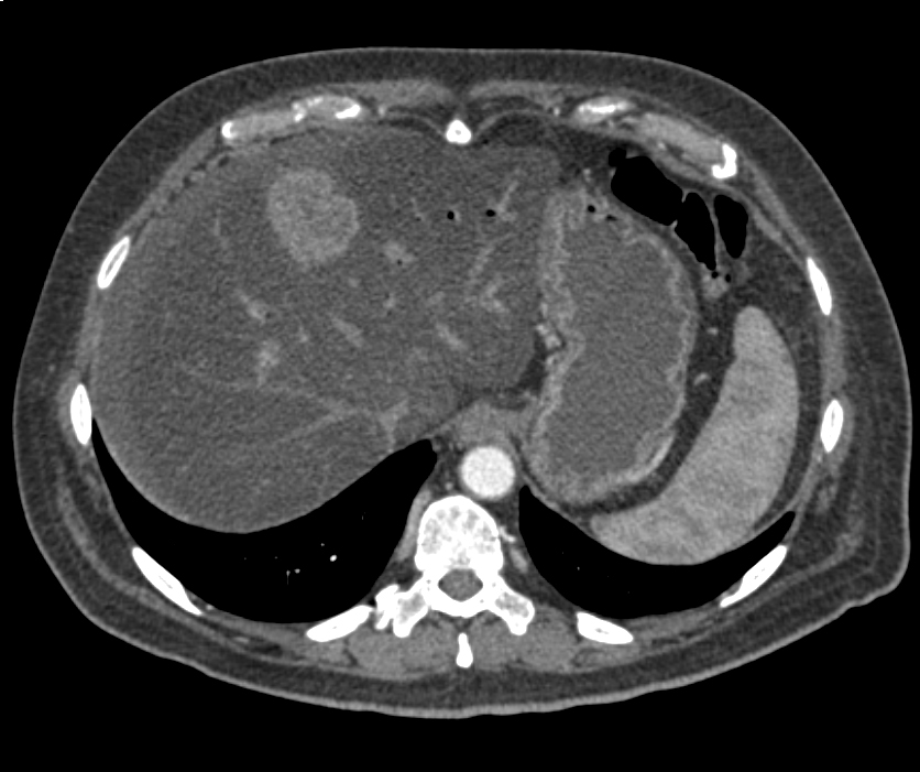 CTisus Quiz