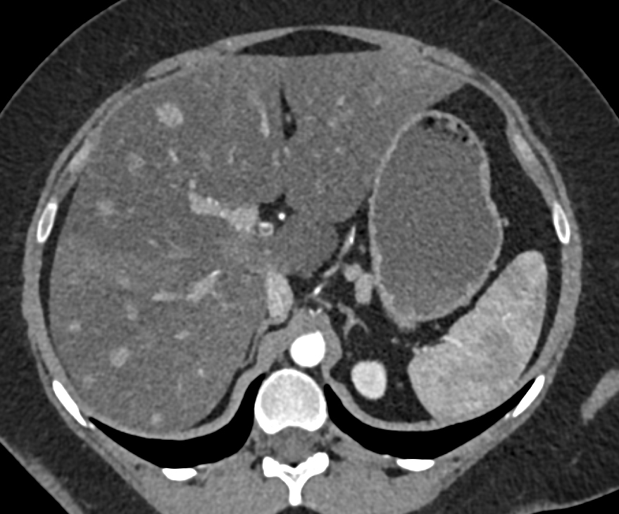 CTisus Quiz