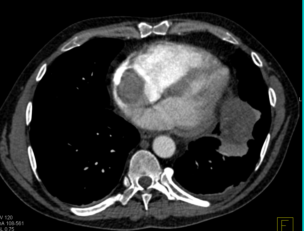 CTisus Quiz