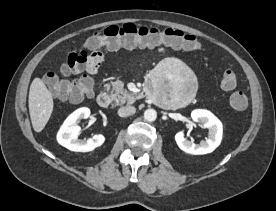 CTisus Quiz
