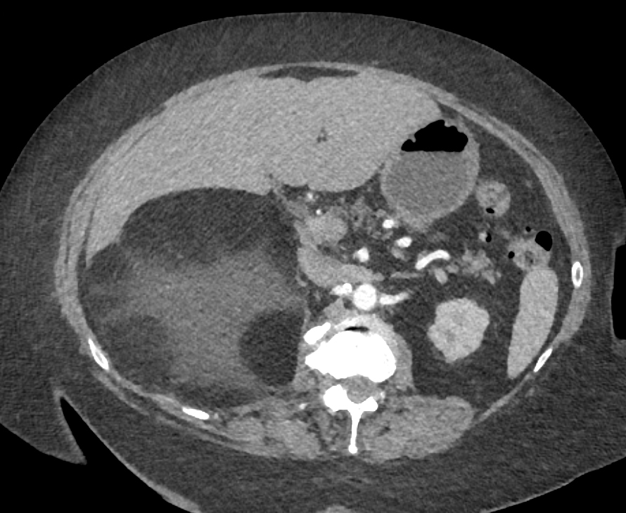 CTisus Quiz