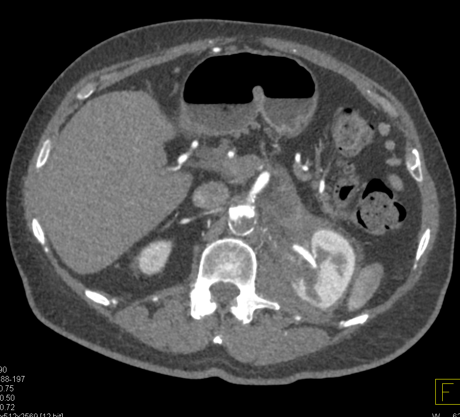 CTisus Quiz