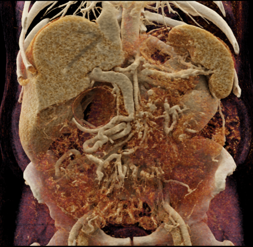 CTisus Quiz