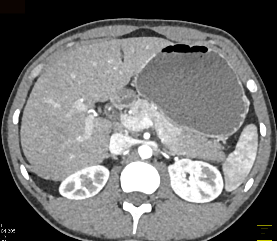 CTisus Quiz