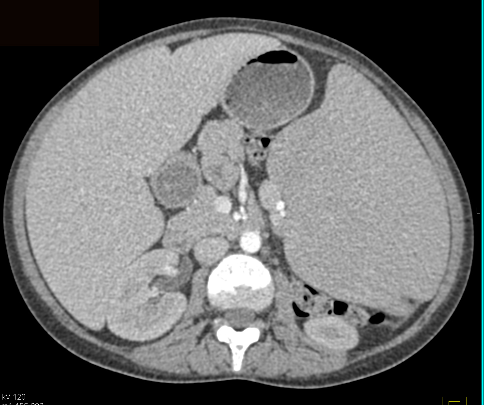 CTisus Quiz