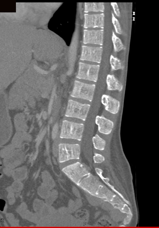 CTisus Quiz