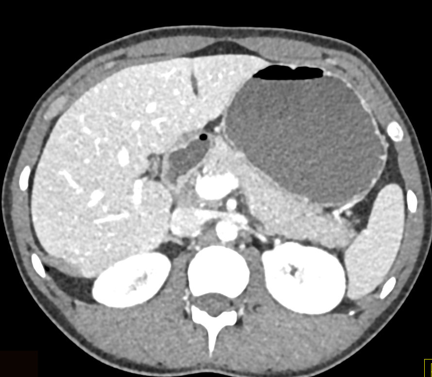 CTisus Quiz