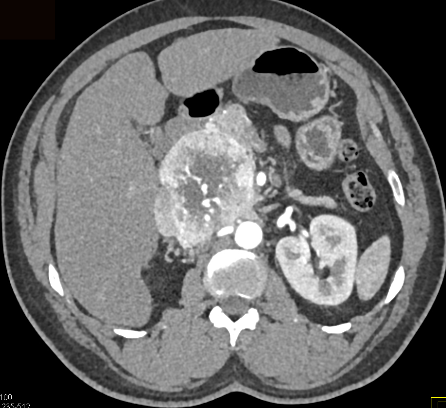 CTisus Quiz