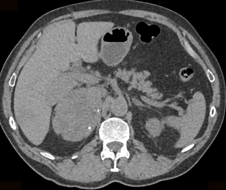 CTisus Quiz