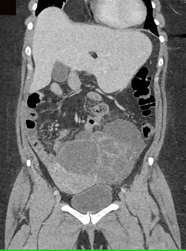 CTisus Quiz