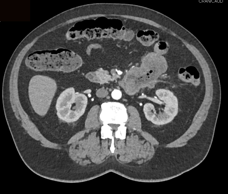 CTisus Quiz