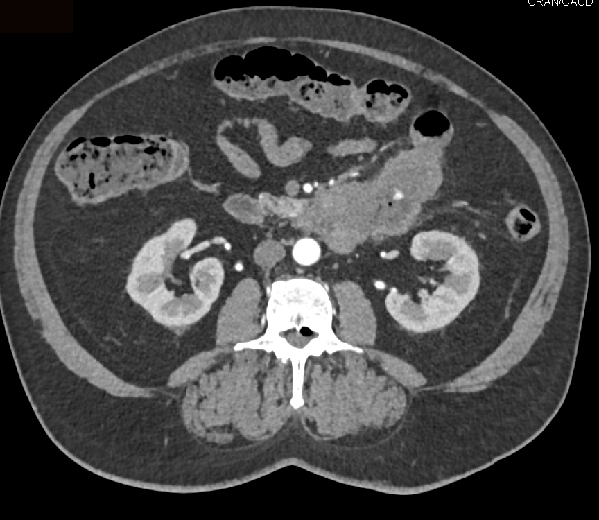 CTisus Quiz