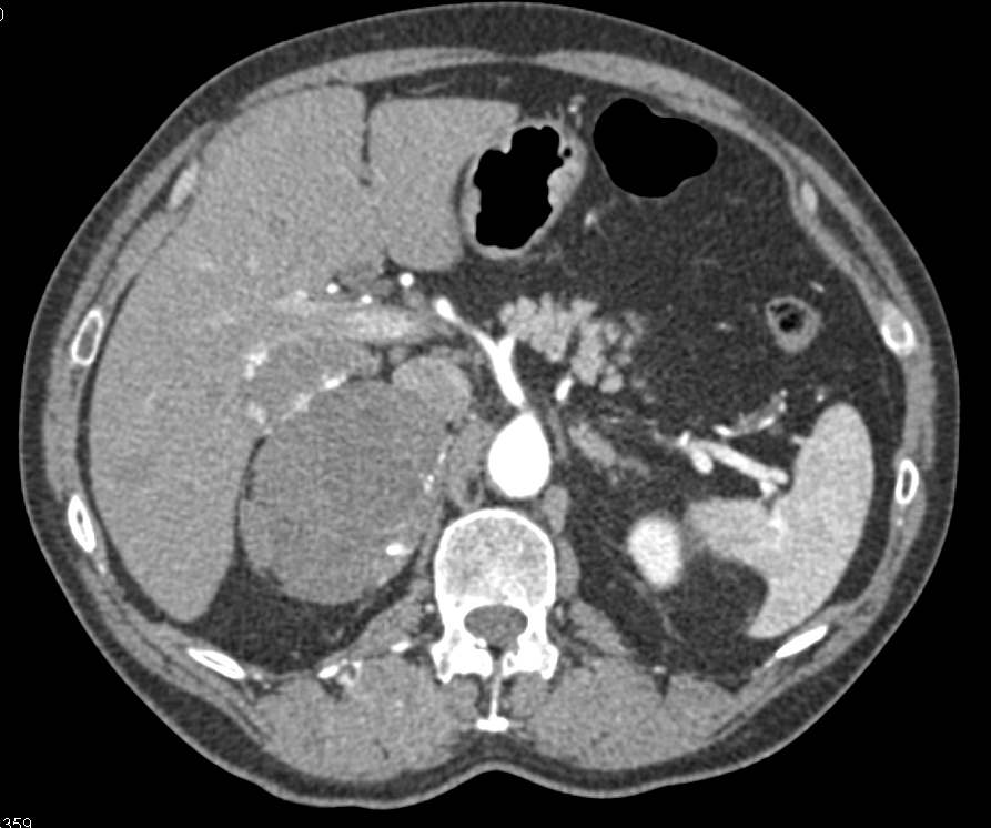 CTisus Quiz