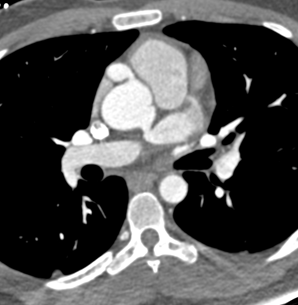 CTisus Quiz