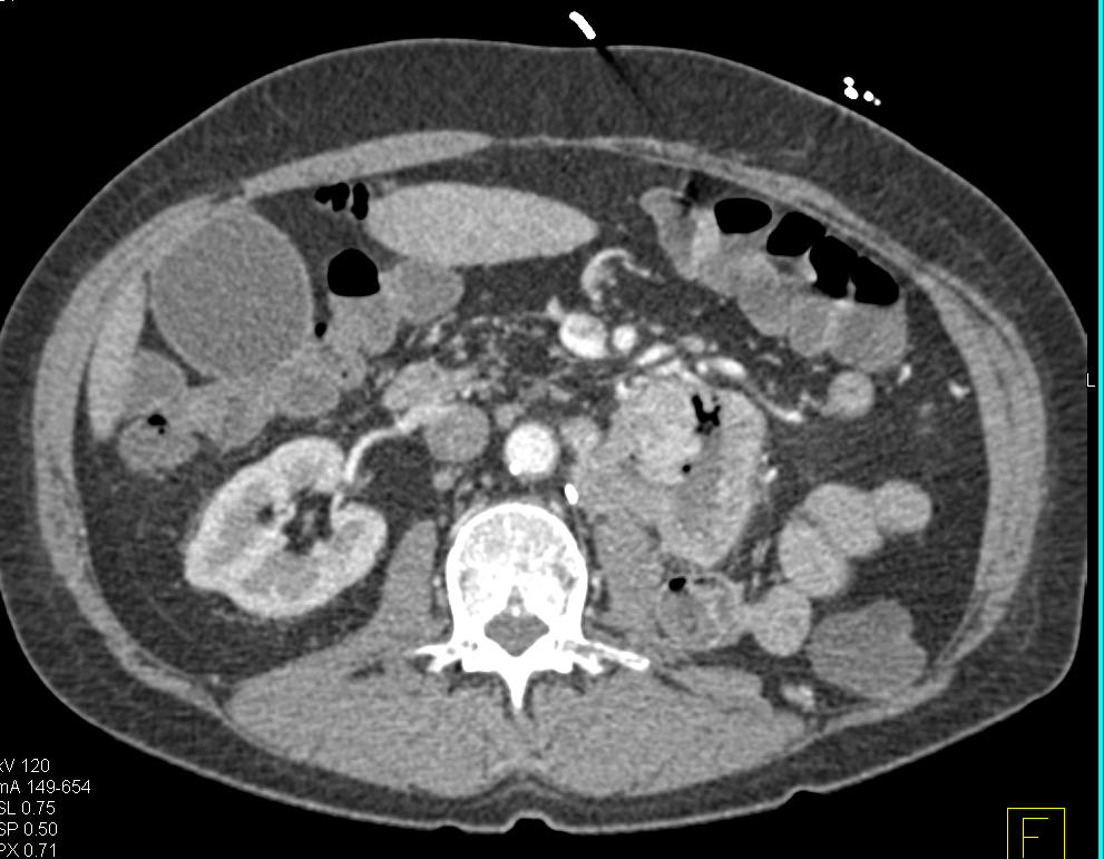 CTisus Quiz
