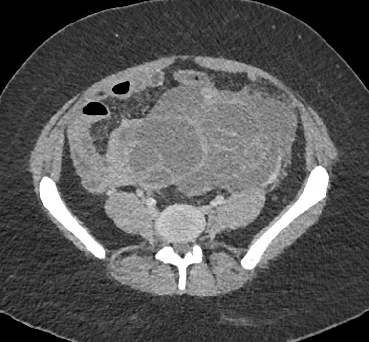 CTisus Quiz